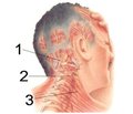 Modern trends in the diagnosis of rare forms of headache (a review of the literature and clinical observation)