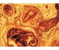 Применение жироплазмотромбоцитарной тканевой смеси в регенерации травматично поврежденного периферического нерва