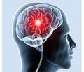 Порівняльна характеристика лікувальних методів усунення гемоконцентрації у хворих із судинними захворюваннями головного мозку