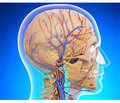 Chronic cerebral venous dysfunction: diagnostic and treatment-and-prophylactic aspects