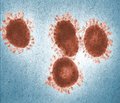 Коронавірусні інфекції:загроза людству з Близького Сходу спричинена MERS-CoV?
