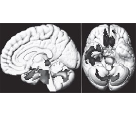 Сучасні аспекти нейропатогенезу й неврологічних проявів COVID-19