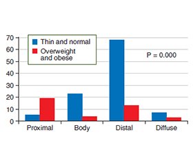 Особливості раку шлунка в Іраку