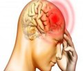 Особливості клінічного перебігу больових синдромів у хворих на мозковий інсульт