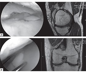 Структура та особливості невогнепальних пошкоджень колінного суглоба серед військовослужбовців Збройних сил України