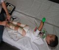 Діагностичні критерії рухових порушень у немовлят із позицій доказової медицини