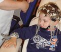 Особливості електроенцефалографічних характеристик у дітей, хворих на епілепсію