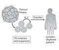 Імунотерапія раку: сучасні можливості та перспективи