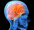 Тактика та результати лікування поєднаної черепно-мозкової травми  