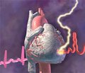Особенности течения ишемической болезни сердца и прогноз больных, перенесших стентирование коронарных артерий  