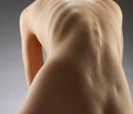 Длительное применение препарата Бонвива® для лечения постменопаузального остеопороза: новые данные