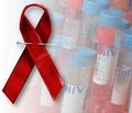Досвід України щодо профілактики ВІЛ-інфекції серед споживачів ін’єкційних наркотиків рекомендують впроваджувати в інших країнах